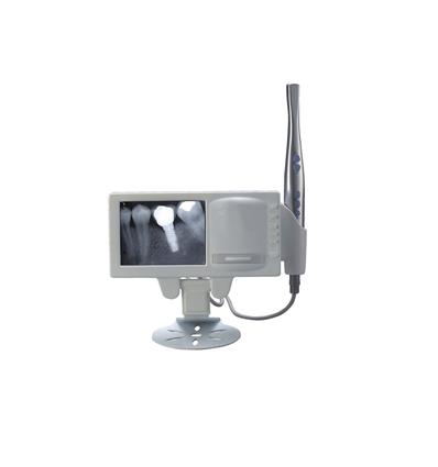 camara-intraoral-con-monitor-y-negatoscopio-digitalizable-168m